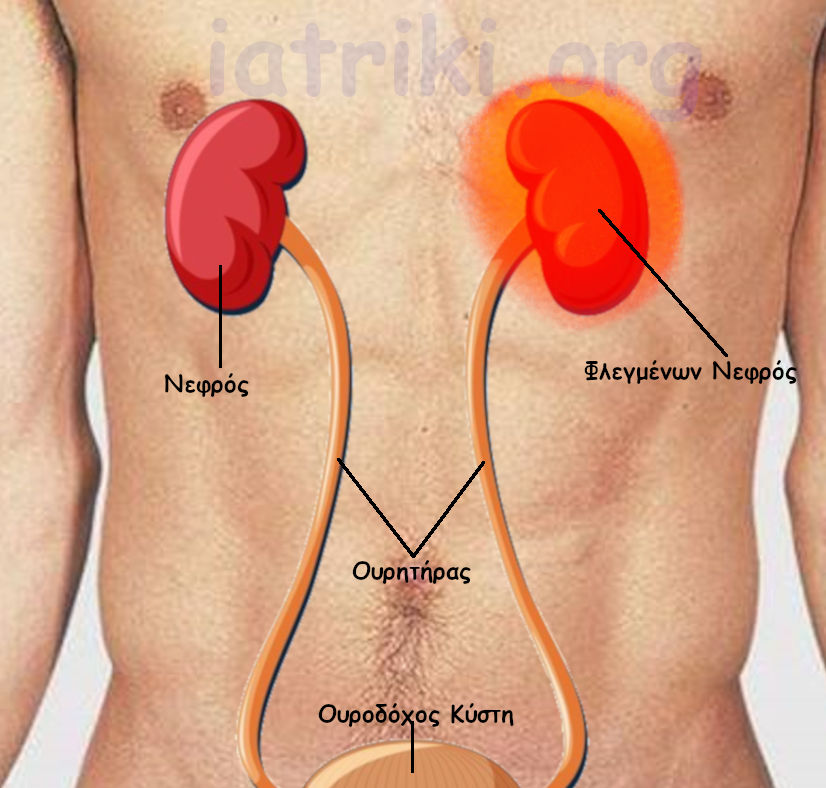 πυελονεφρίτιδα ανατομια ουροποιτικου